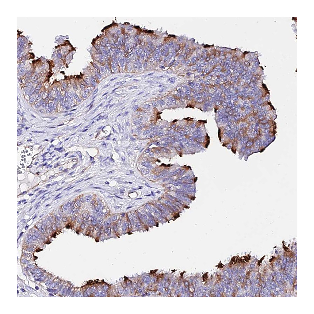 Atlas Antibodies Anti-DAW1 Antibody