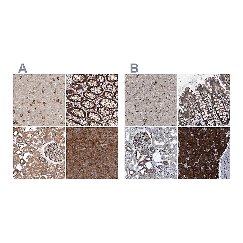 Atlas Antibodies Anti-DARS Antibody