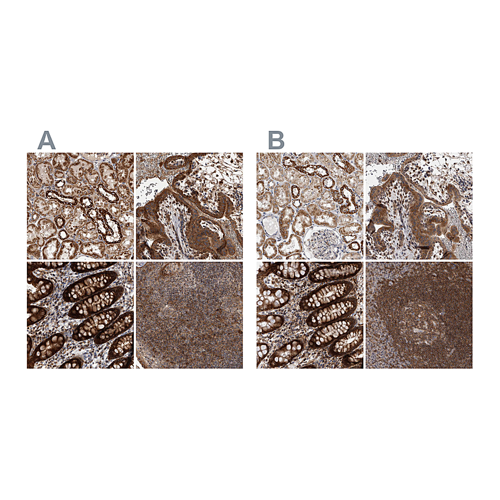 Atlas Antibodies Anti-DARS2 Antibody
