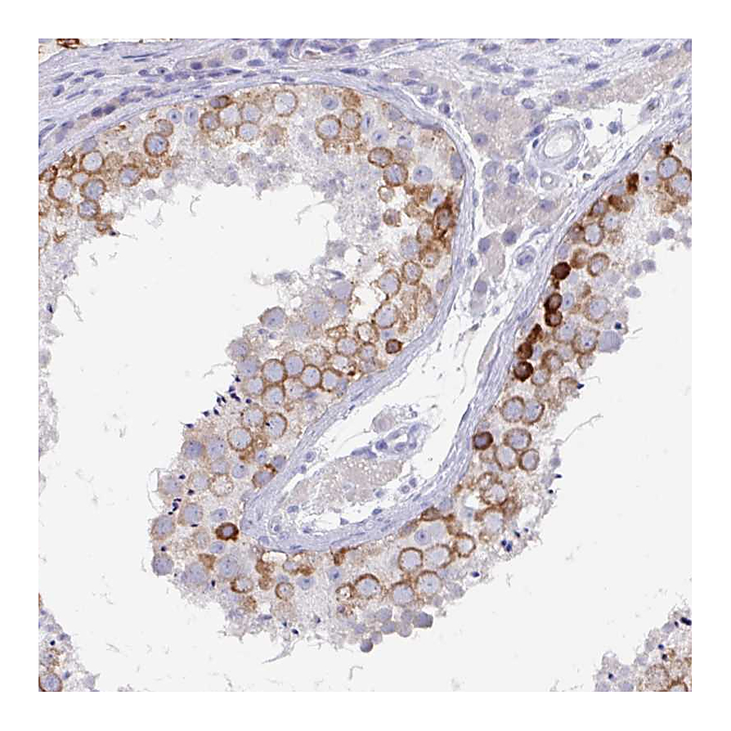 Atlas Antibodies Anti-DAZ1 Antibody