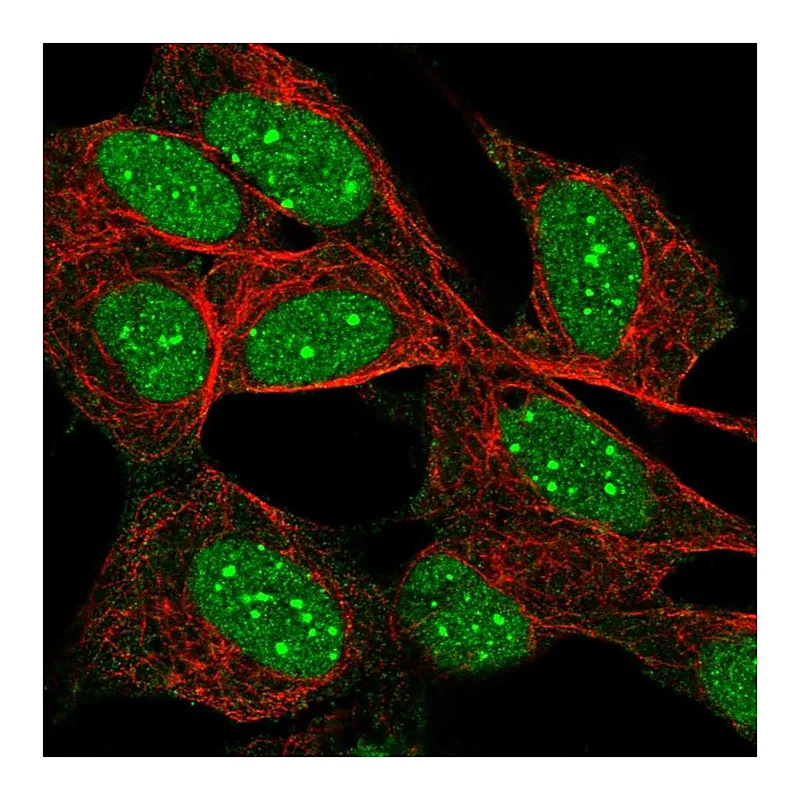 Atlas Antibodies Anti-DAXX Antibody