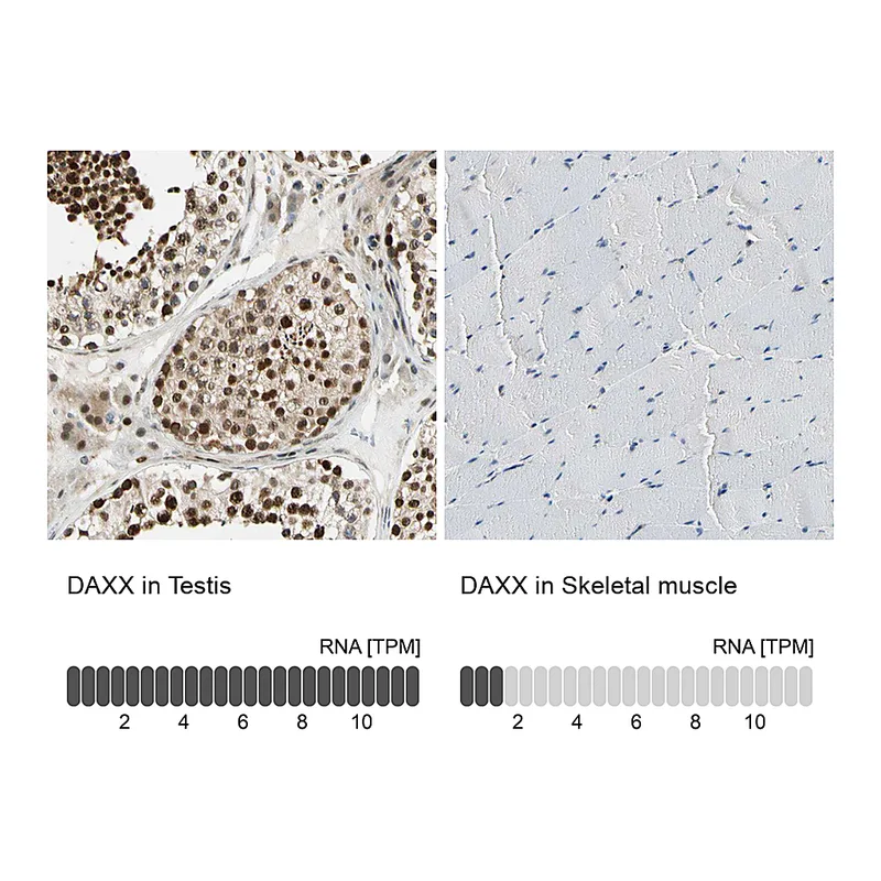 Atlas Antibodies Anti-DAXX Antibody