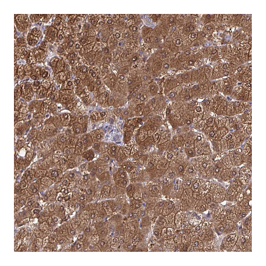 Atlas Antibodies Anti-DBI Antibody