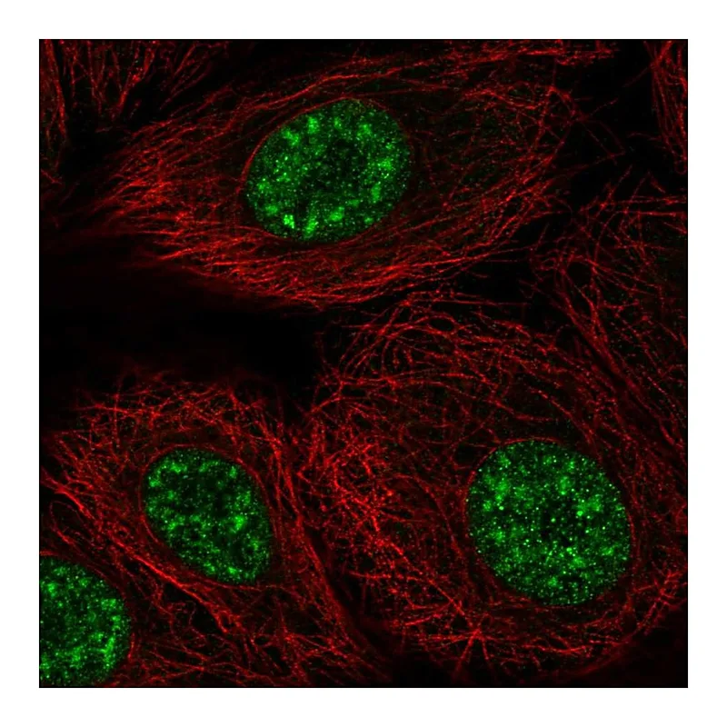 Atlas Antibodies Anti-DAZAP2 Antibody