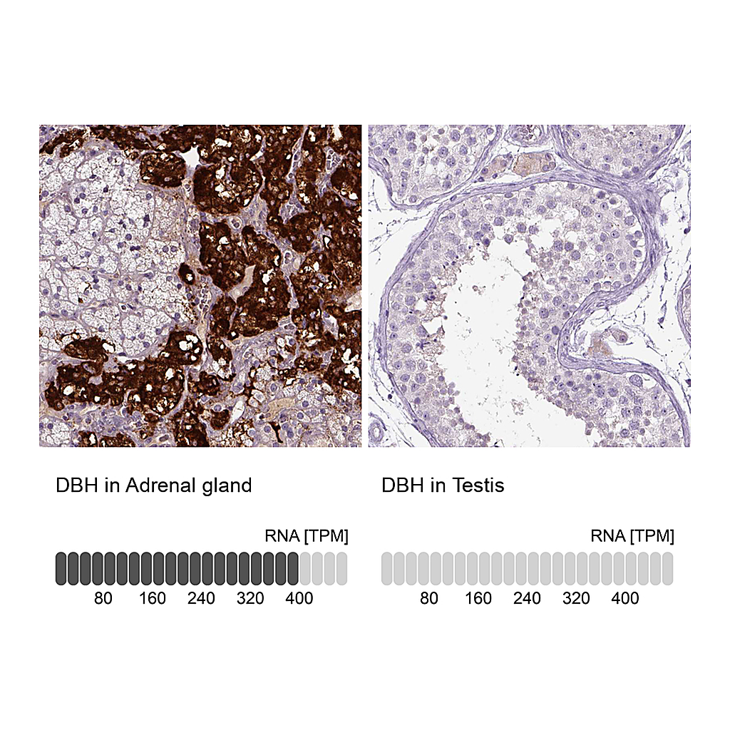 Atlas Antibodies Anti-DBH Antibody