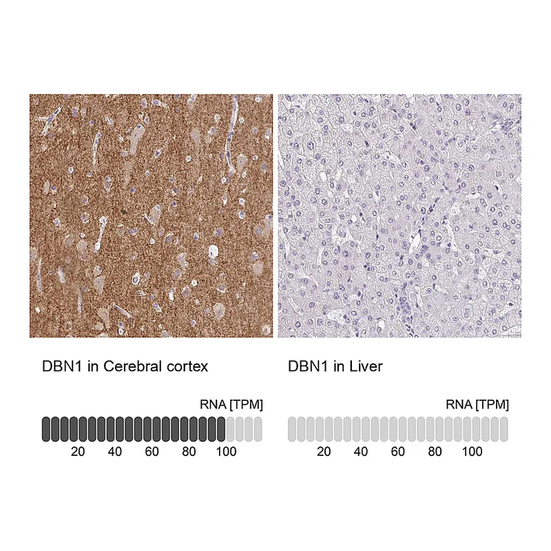 Atlas Antibodies Anti-DBN1 Antibody