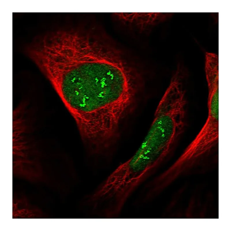 Atlas Antibodies Anti-DCAF1 Antibody