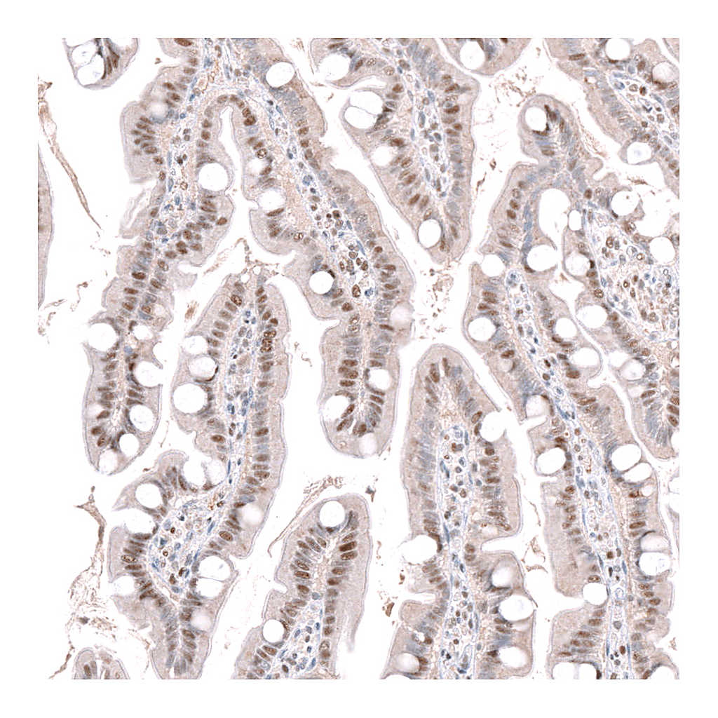 Atlas Antibodies Anti-DCAF13 Antibody