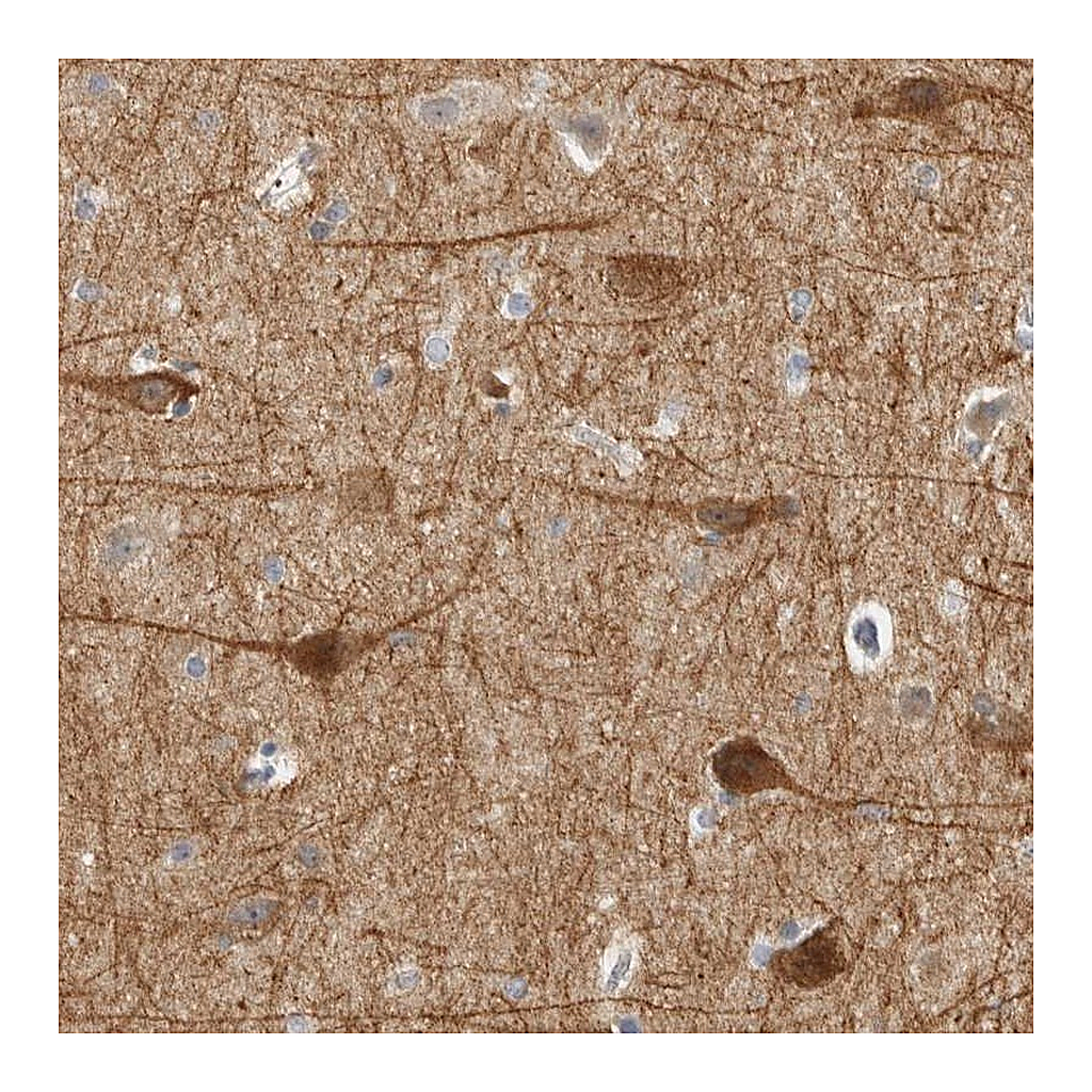 Atlas Antibodies Anti-DCAF10 Antibody