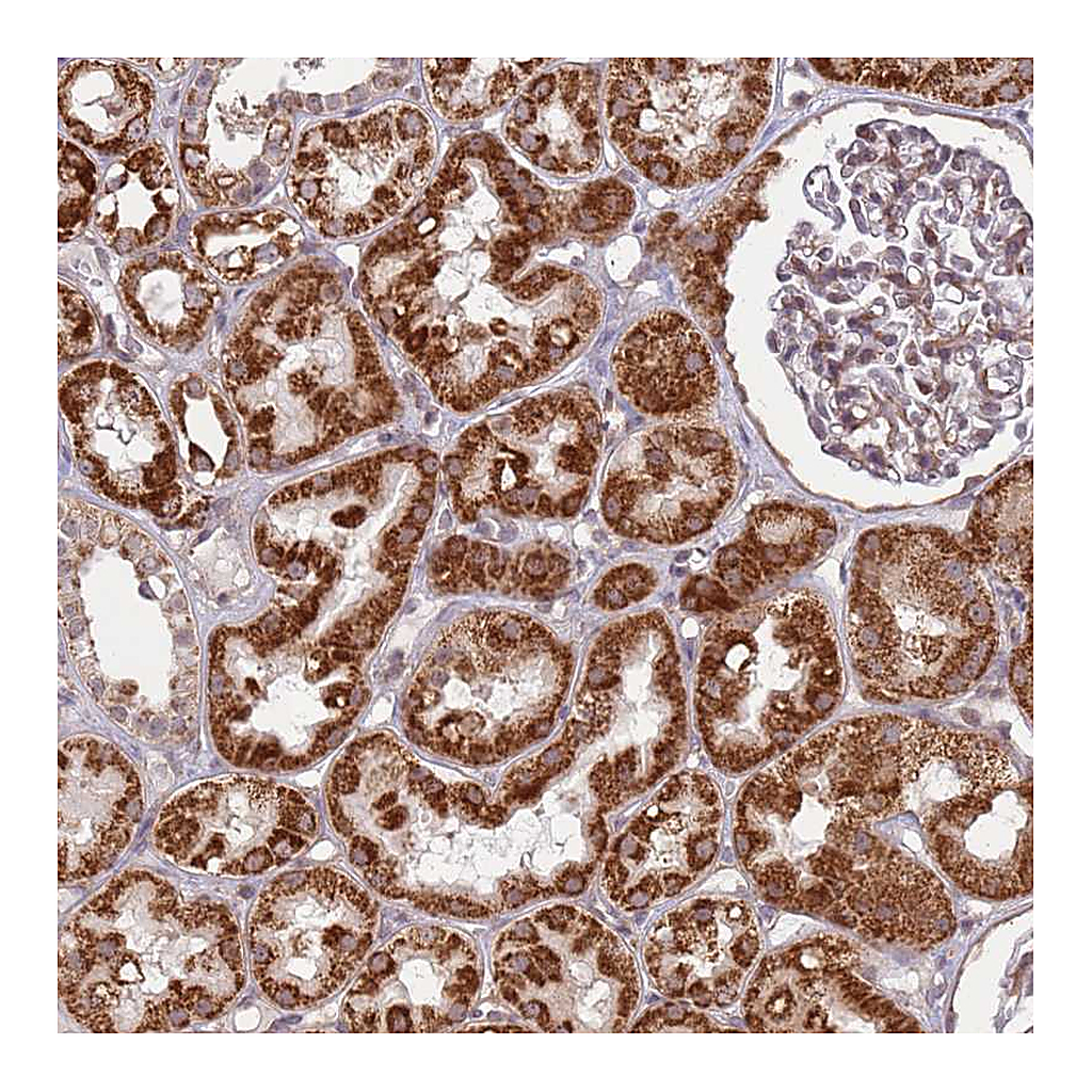 Atlas Antibodies Anti-DCAF4 Antibody