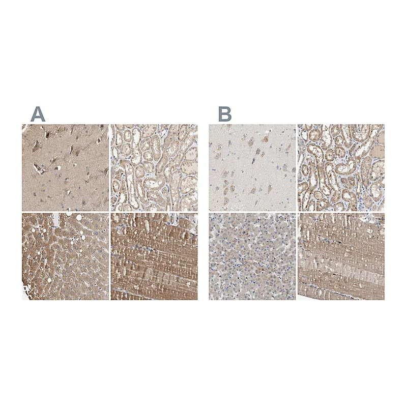 Atlas Antibodies Anti-DCAF7 Antibody