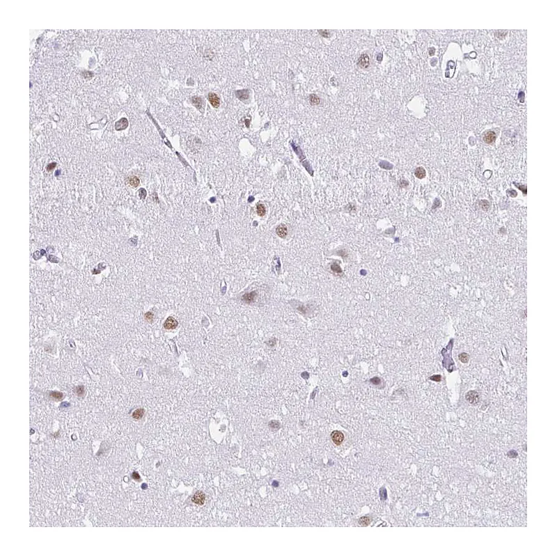 Atlas Antibodies Anti-DCAF17 Antibody