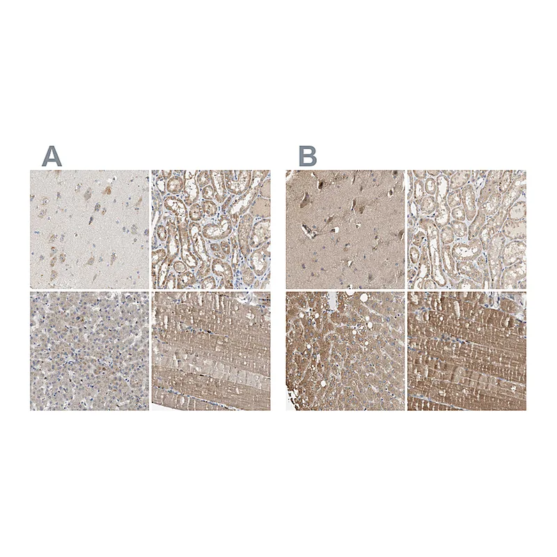Atlas Antibodies Anti-DCAF7 Antibody