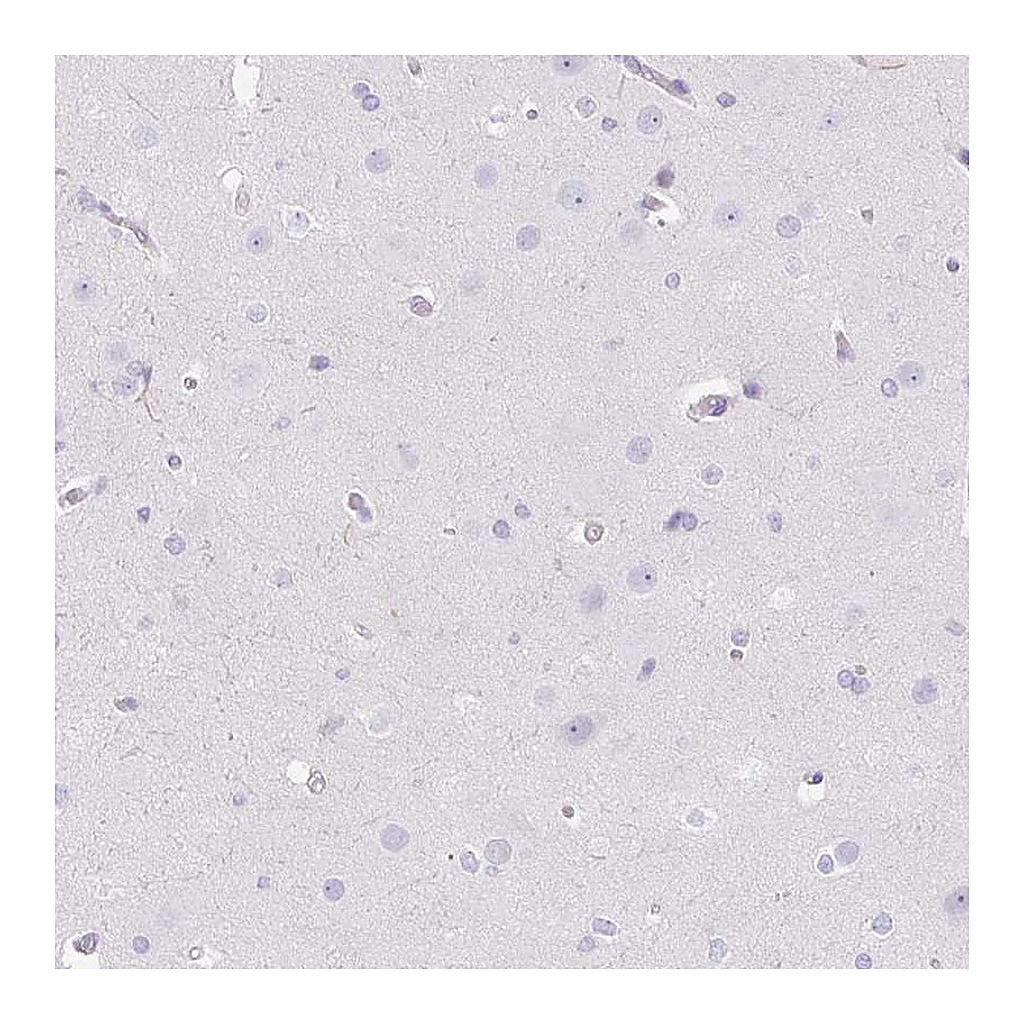 Atlas Antibodies Anti-DCAF17 Antibody