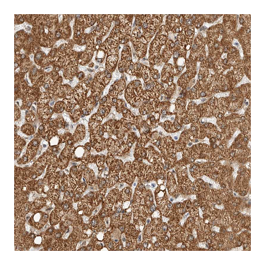 Atlas Antibodies Anti-DCAF8 Antibody
