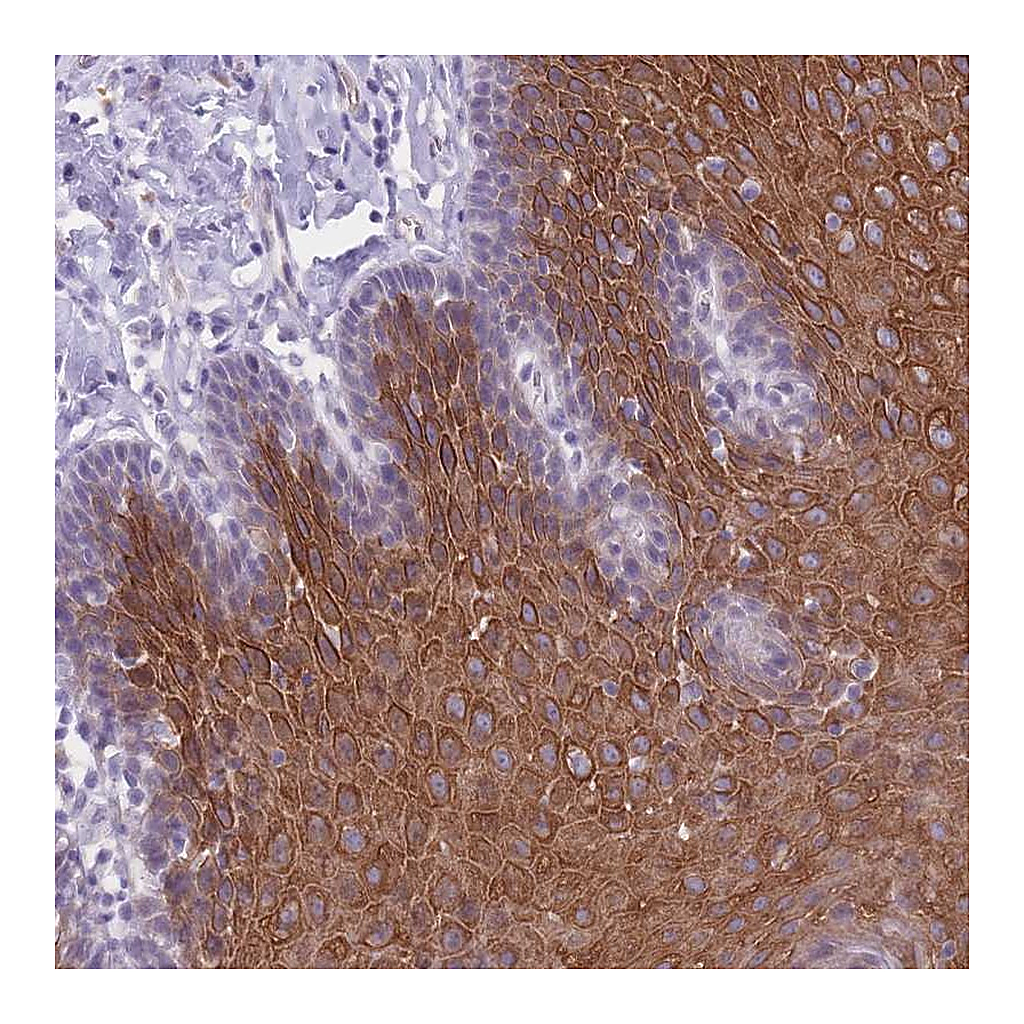 Atlas Antibodies Anti-DCANP1 Antibody