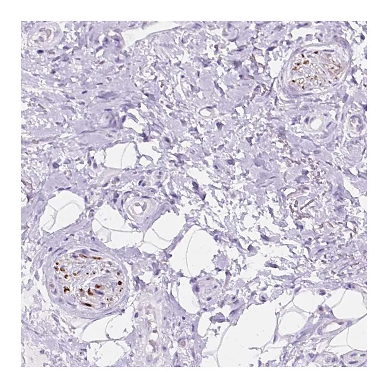 Atlas Antibodies Anti-DCC Antibody