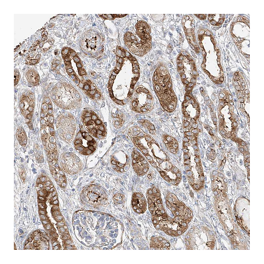 Atlas Antibodies Anti-DCDC2 Antibody