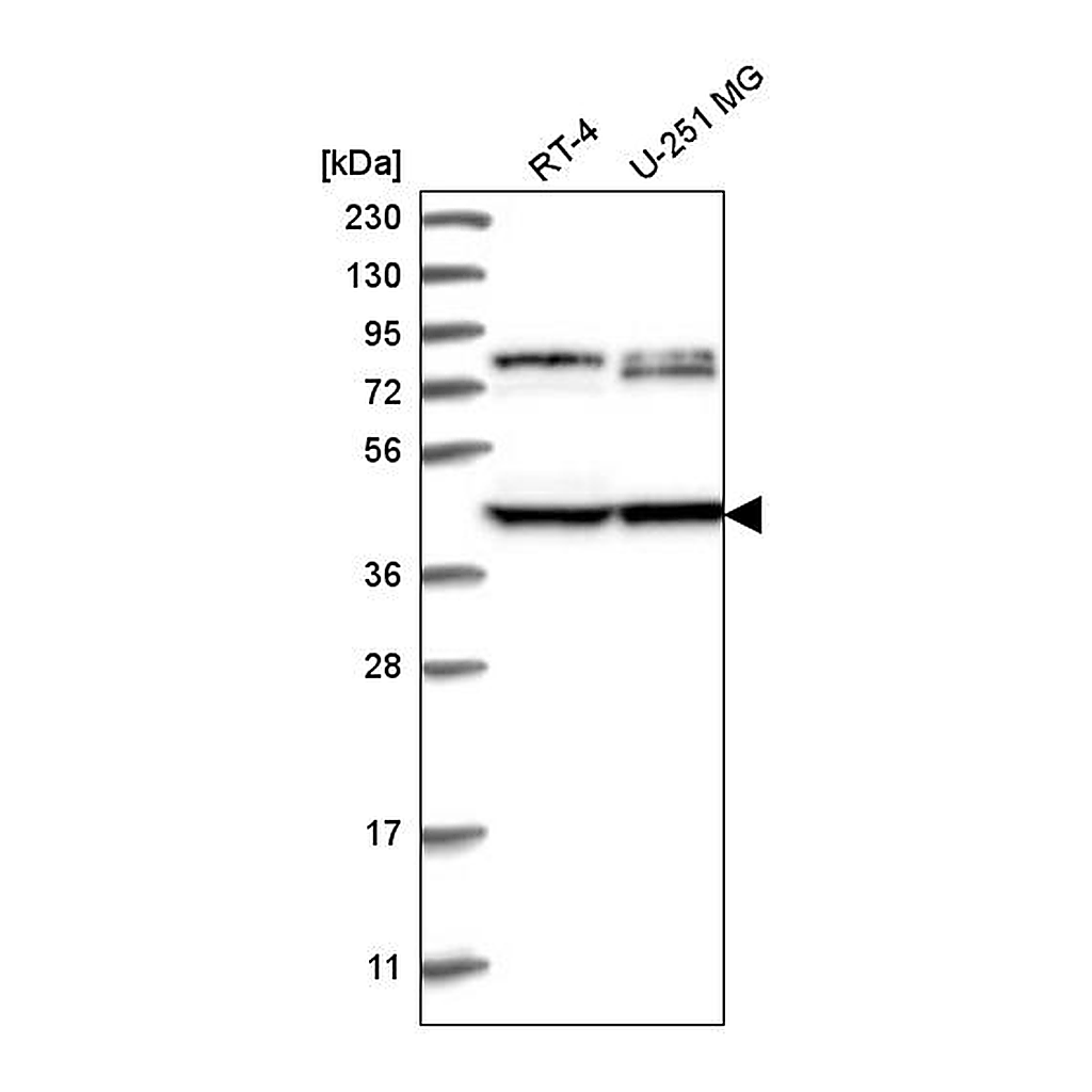 Atlas Antibodies Anti-DCDC2 Antibody