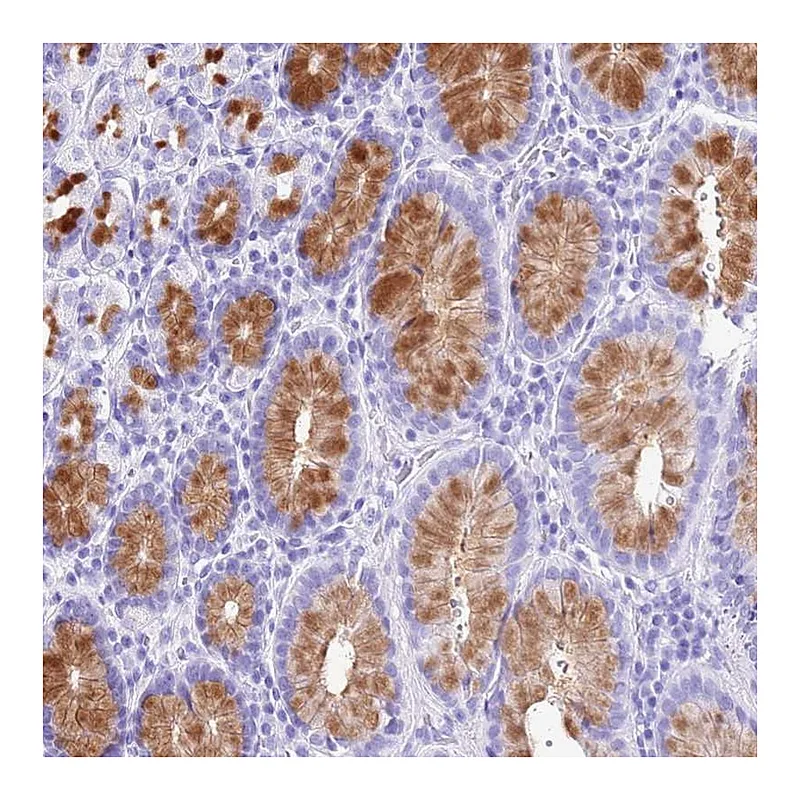 Atlas Antibodies Anti-DCDC2B Antibody