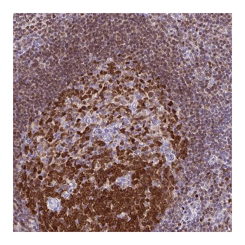 Atlas Antibodies Anti-DCK Antibody