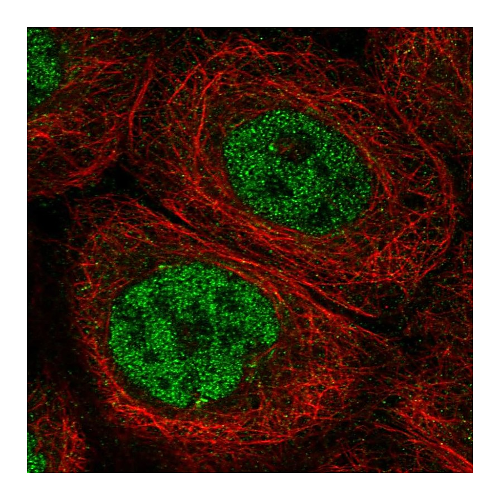 Atlas Antibodies Anti-DCLRE1C Antibody