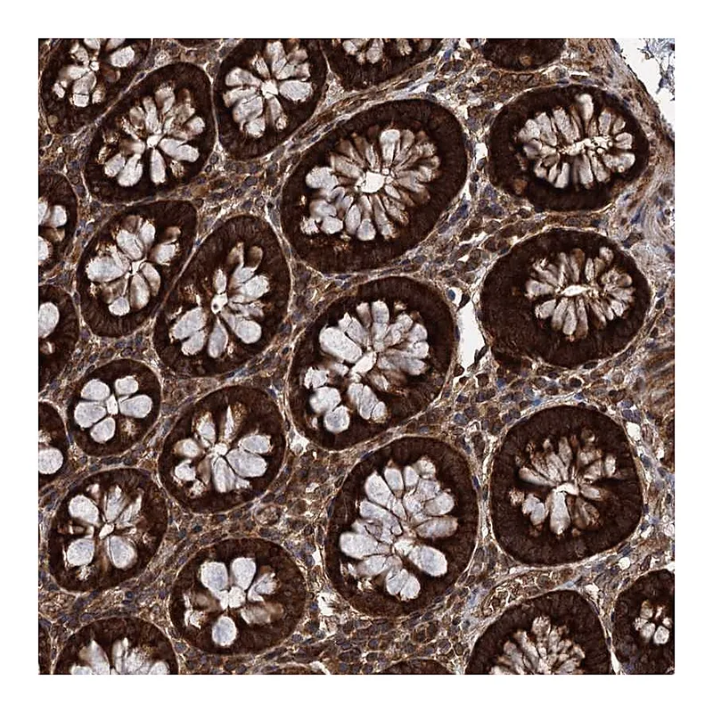 Atlas Antibodies Anti-DCP1B Antibody