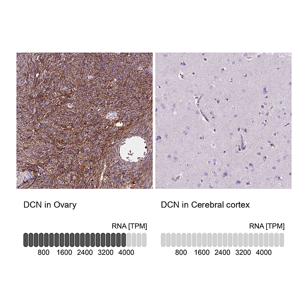 Atlas Antibodies Anti-DCN Antibody