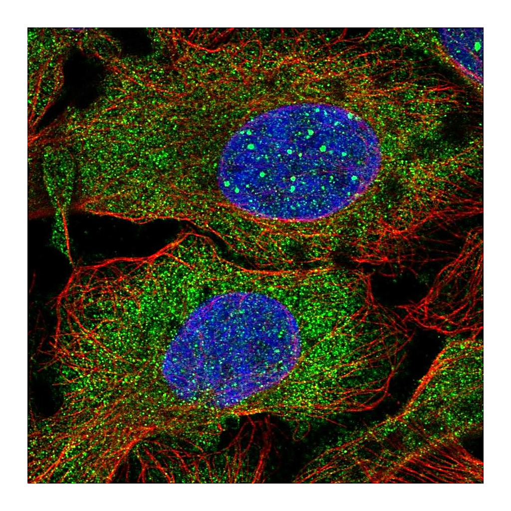 Atlas Antibodies Anti-DCP1B Antibody