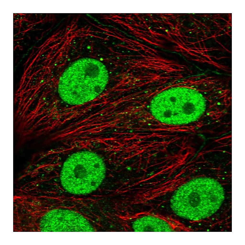 Atlas Antibodies Anti-DCP2 Antibody