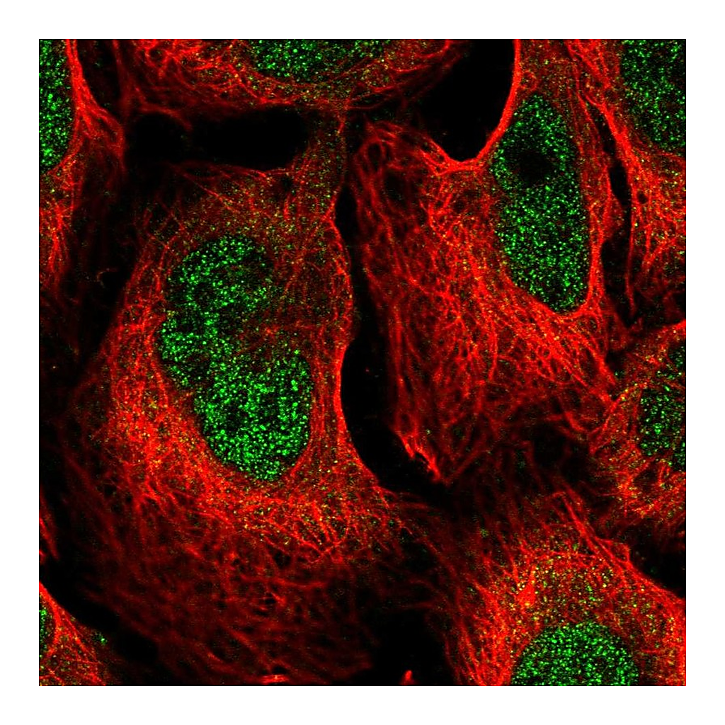 Atlas Antibodies Anti-DCPS Antibody
