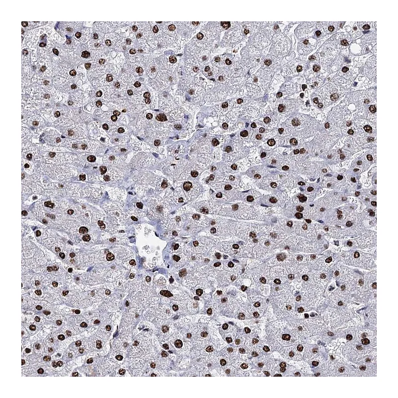 Atlas Antibodies Anti-DCPS Antibody