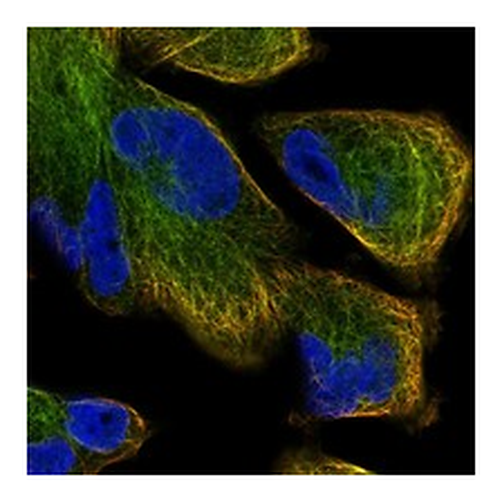 Atlas Antibodies Anti-DCTN1 Antibody