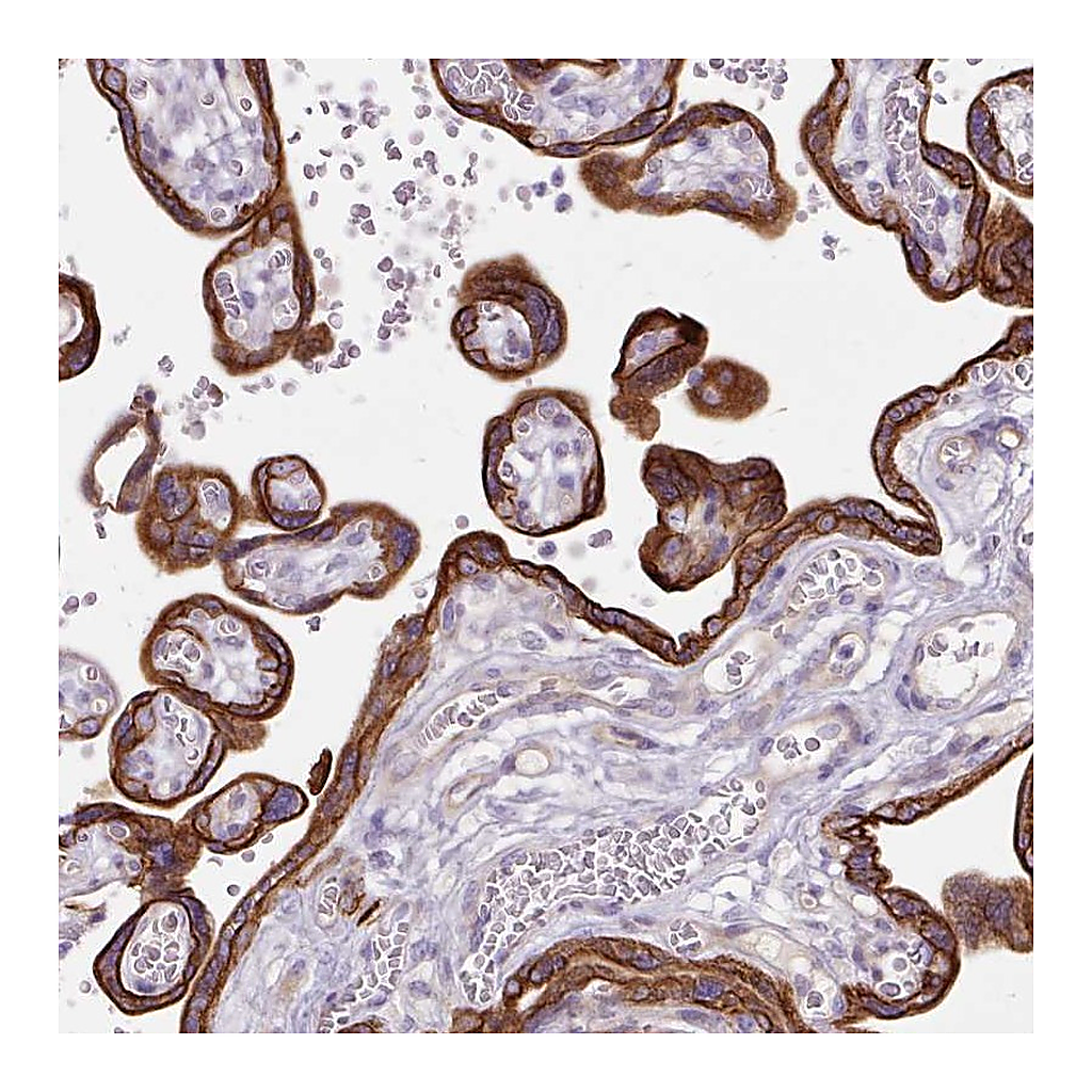 Atlas Antibodies Anti-DCTN4 Antibody
