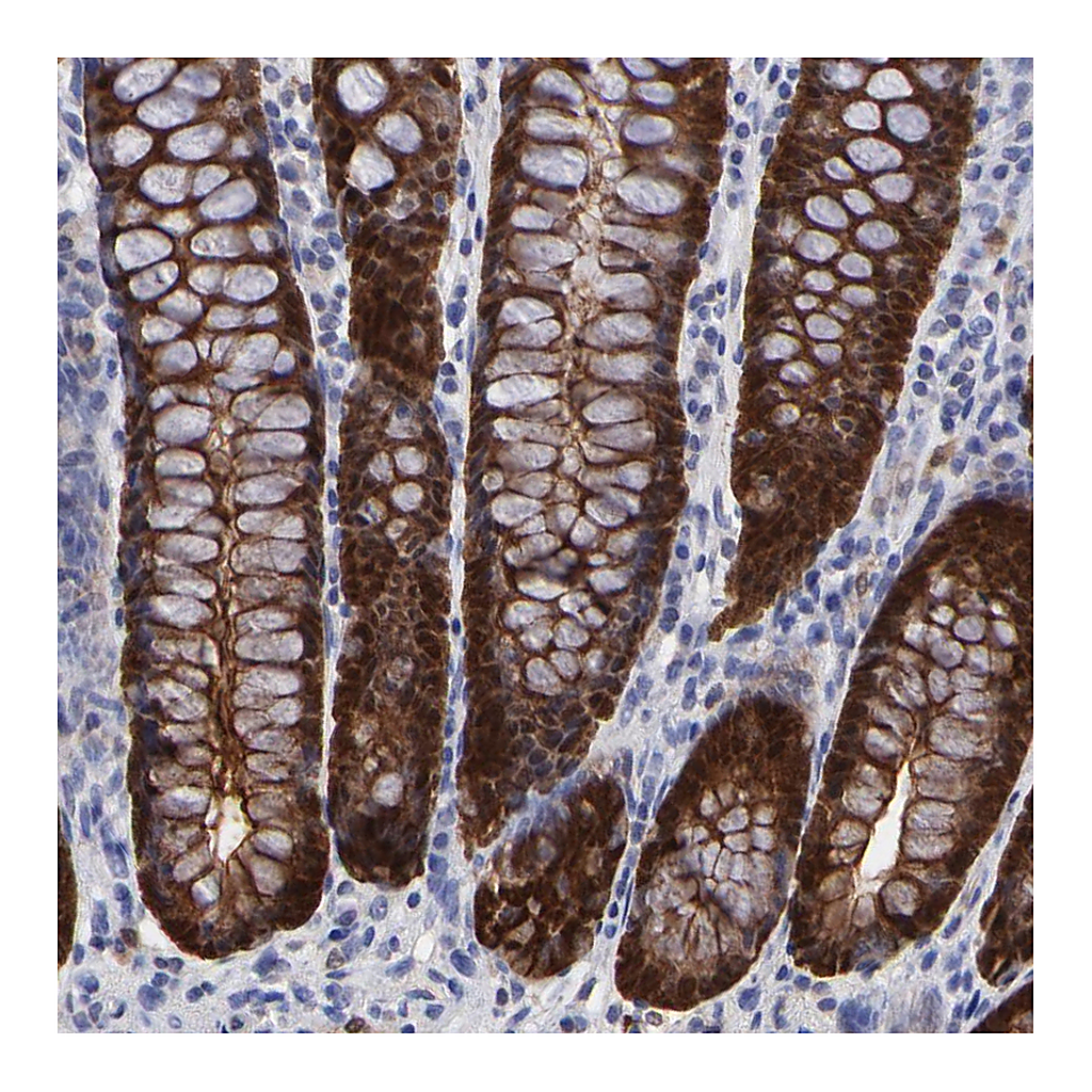 Atlas Antibodies Anti-DCTPP1 Antibody