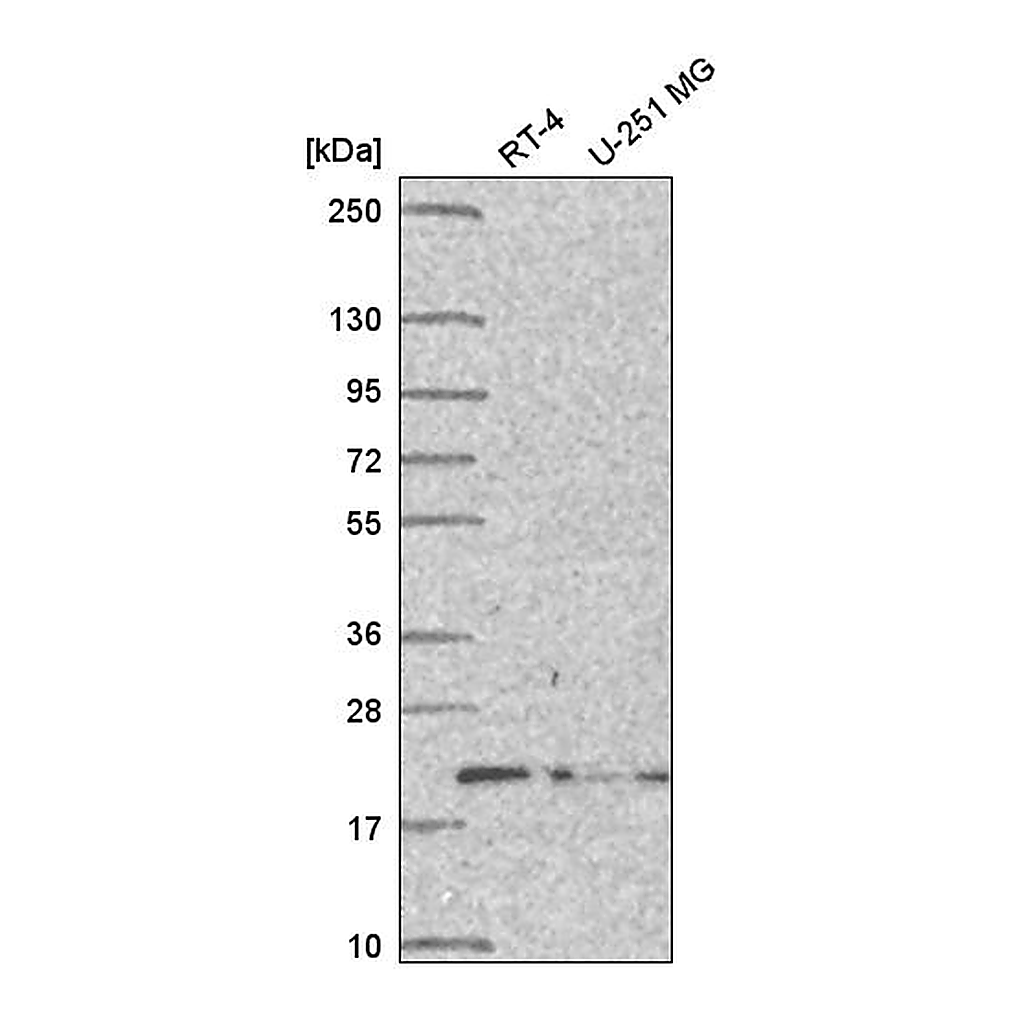 Atlas Antibodies Anti-DCTN5 Antibody