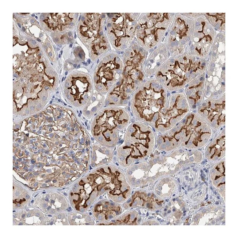 Atlas Antibodies Anti-DCTN6 Antibody