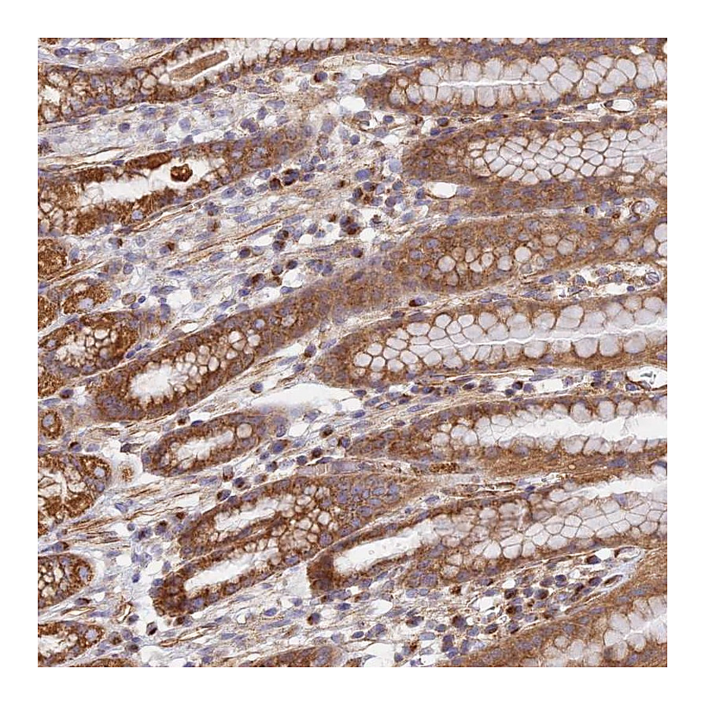 Atlas Antibodies Anti-DDA1 Antibody