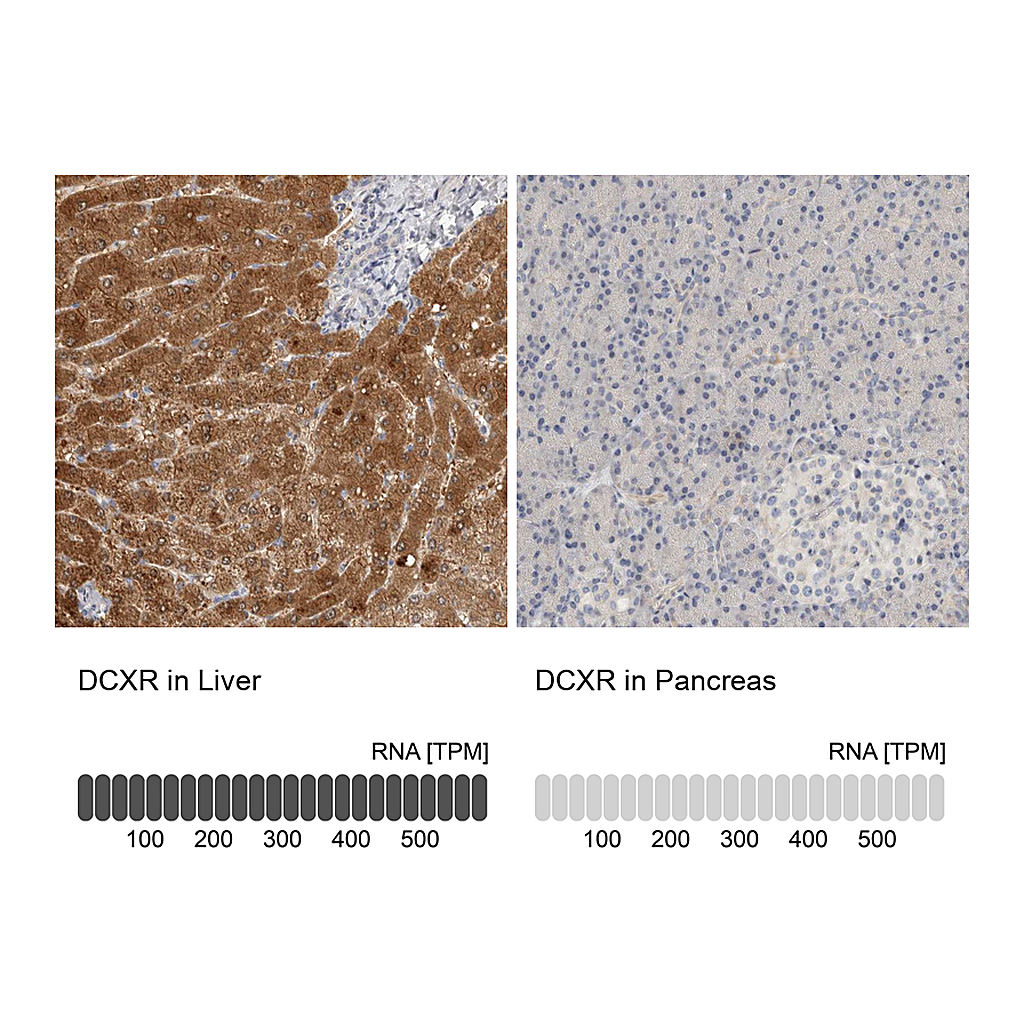 Atlas Antibodies Anti-DCXR Antibody