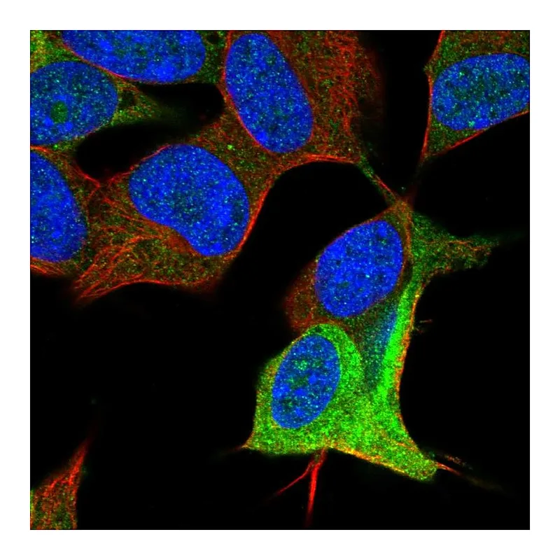 Atlas Antibodies Anti-DCX Antibody