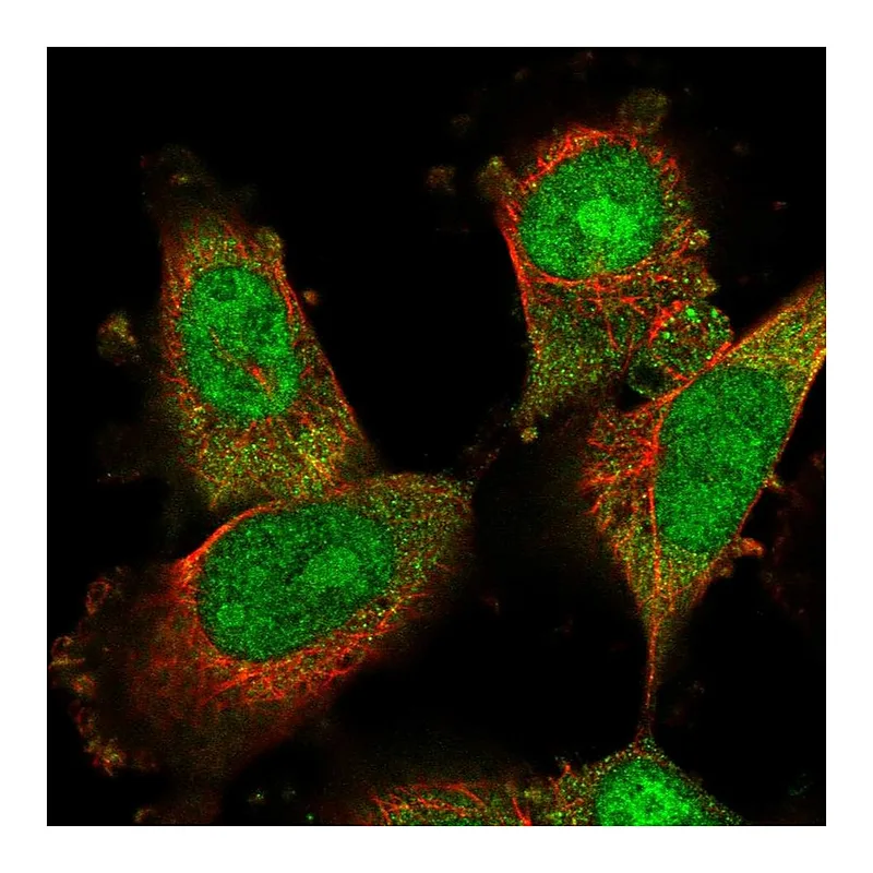 Atlas Antibodies Anti-DDA1 Antibody