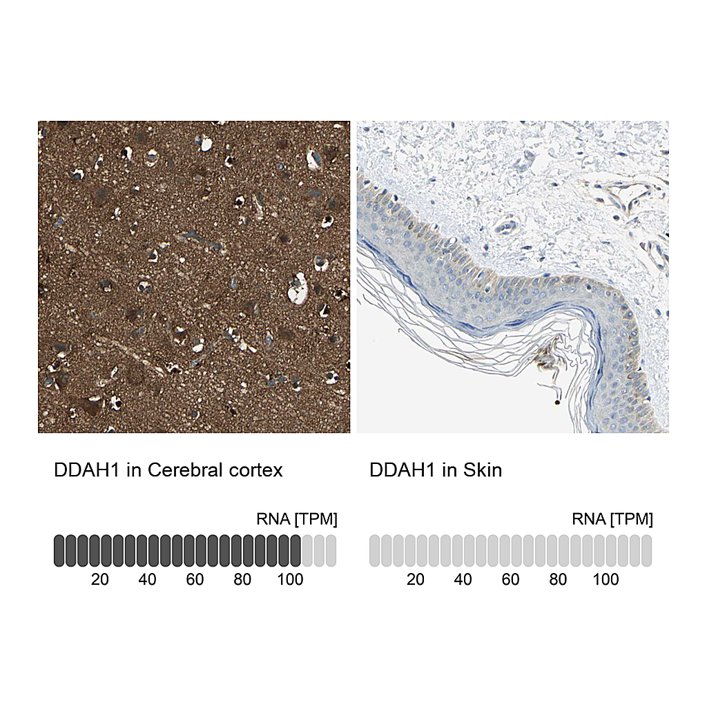 Atlas Antibodies Anti-DDAH1 Antibody