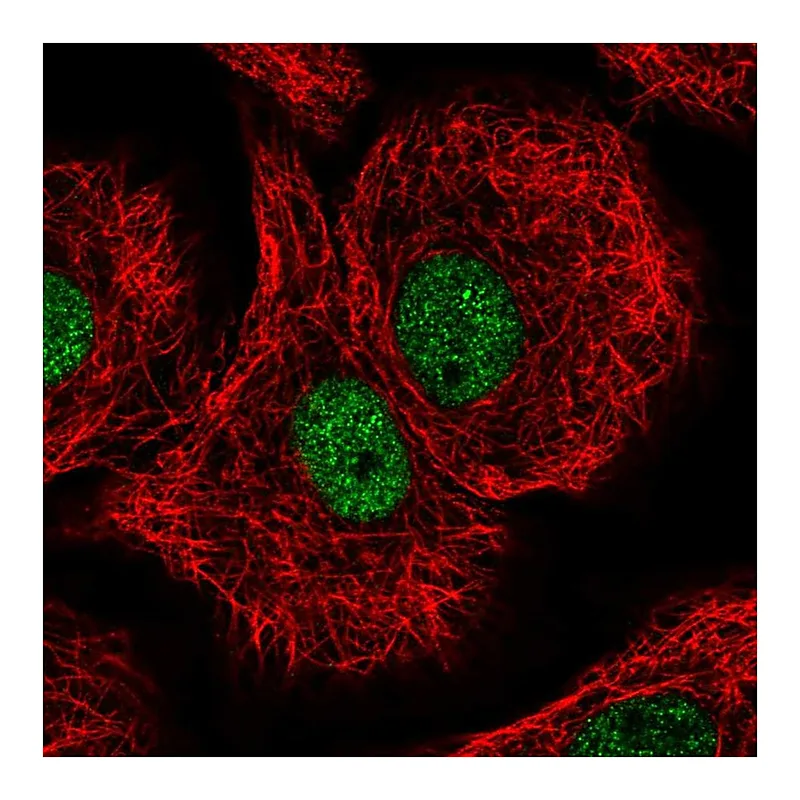 Atlas Antibodies Anti-DDB1 Antibody