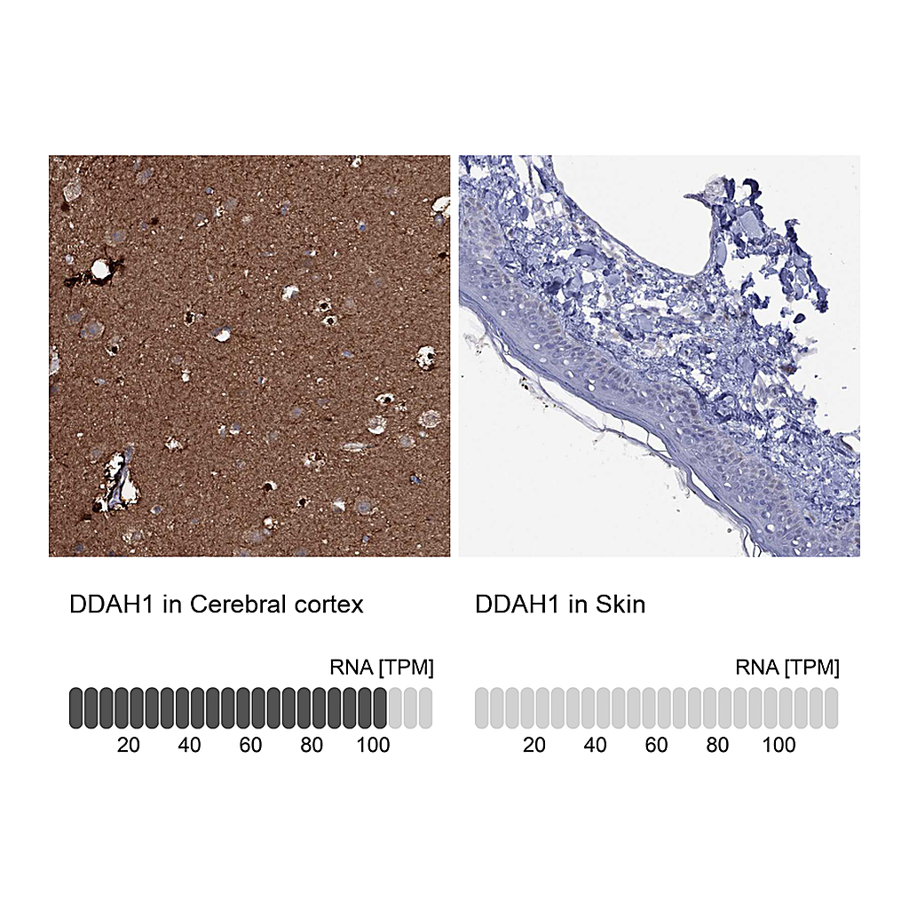 Atlas Antibodies Anti-DDAH1 Antibody