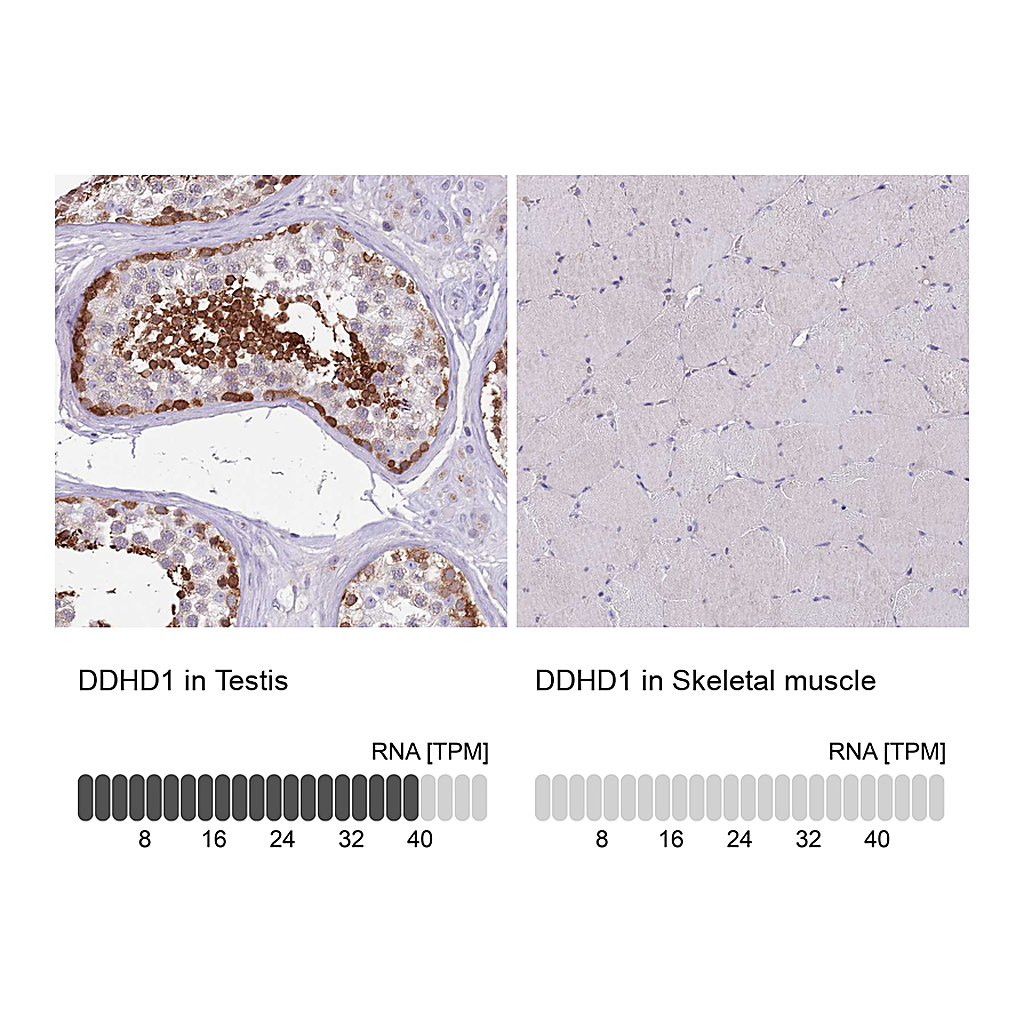 Atlas Antibodies Anti-DDHD1 Antibody
