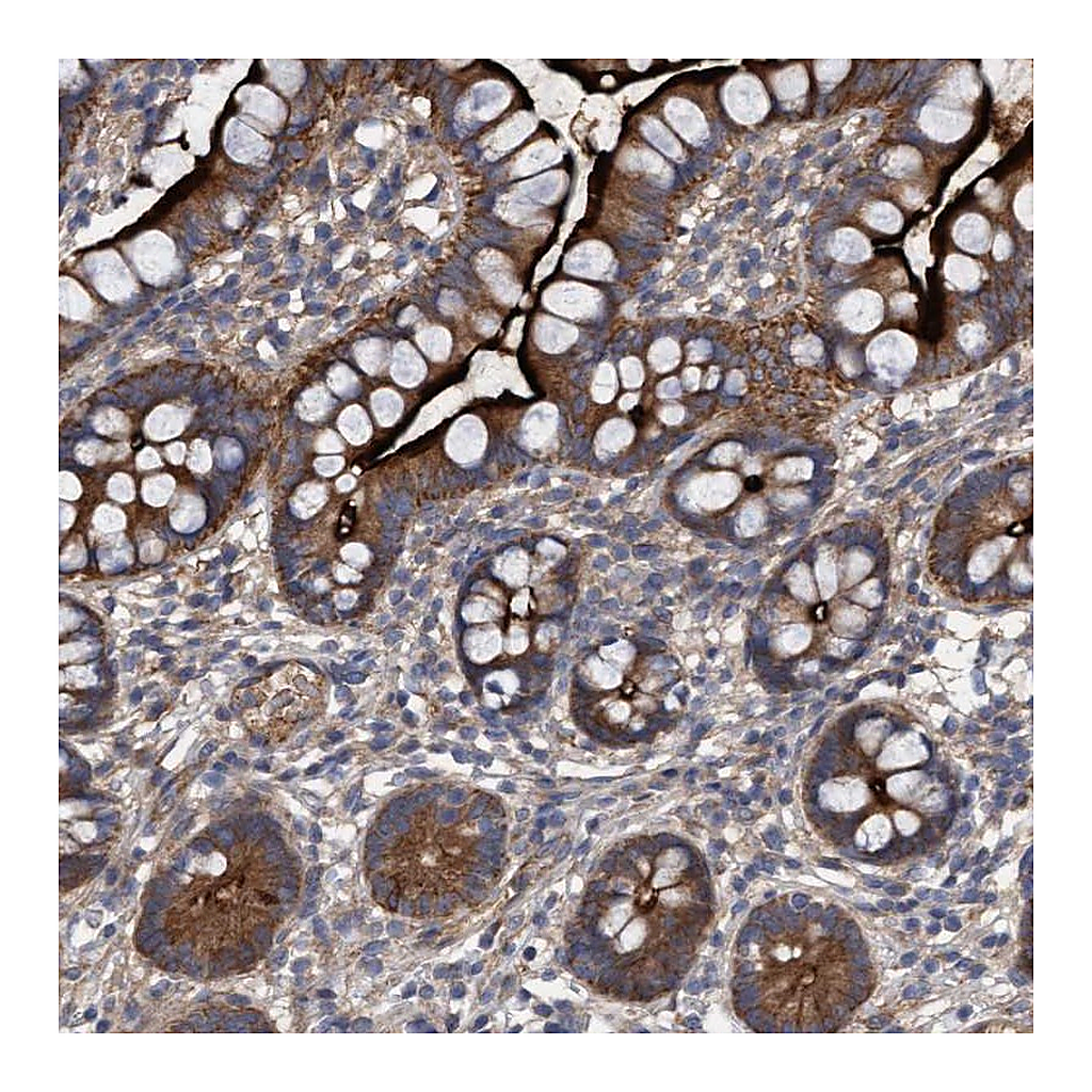 Atlas Antibodies Anti-DDHD2 Antibody