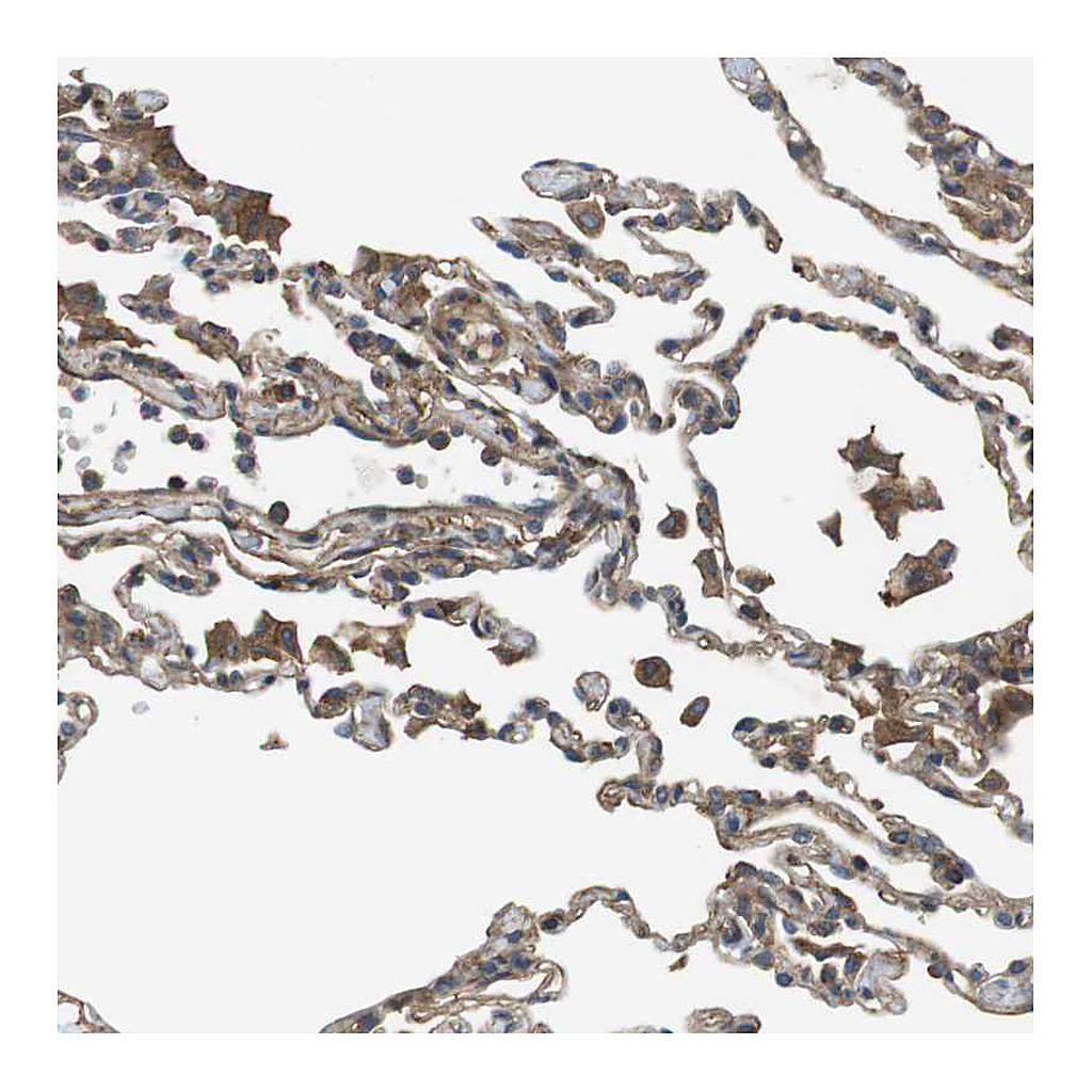 Atlas Antibodies Anti-DDAH2 Antibody