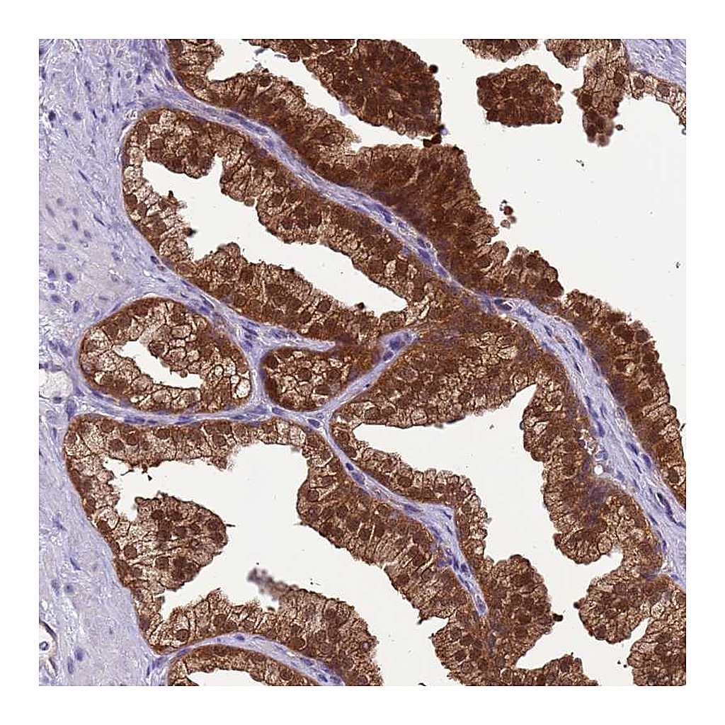 Atlas Antibodies Anti-DDI2 Antibody