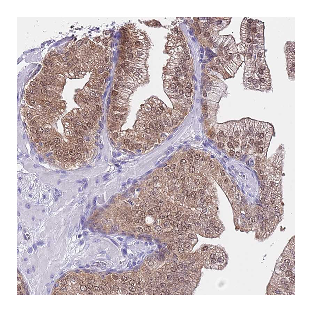Atlas Antibodies Anti-DDI2 Antibody