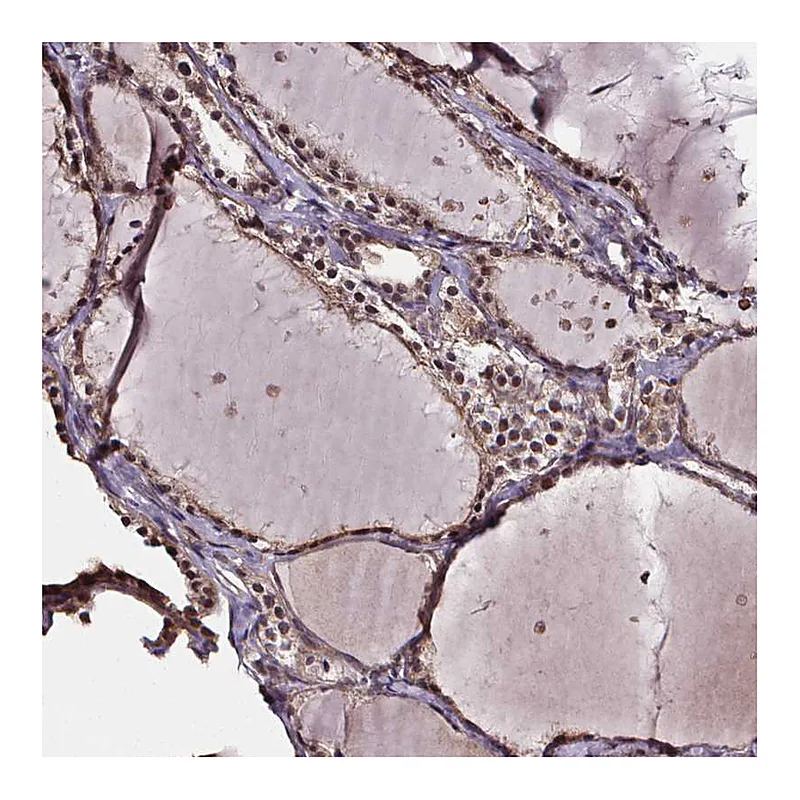 Atlas Antibodies Anti-DDIT3 Antibody